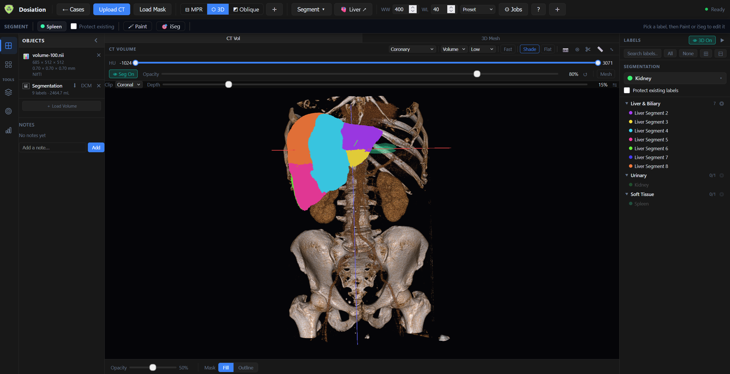 3D mesh with liver segment labels for surgical planning